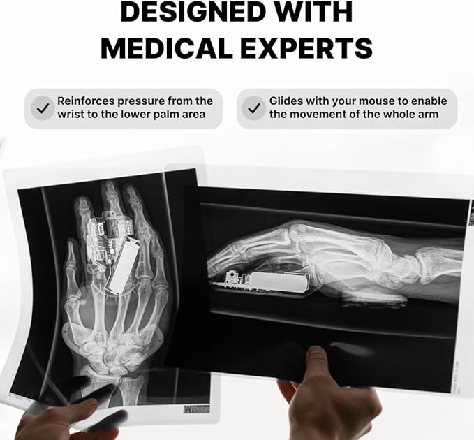 DELTAHUB Carpio 2.0 - Right-Handed Truly Ergonomic Wrist Rest for Mouse, Carpal Tunnel Support, Pain Relief, Anti-Fatigue, Easy Glide, Sleek, Office Computer, Laptop, Gaming - Small, Grey