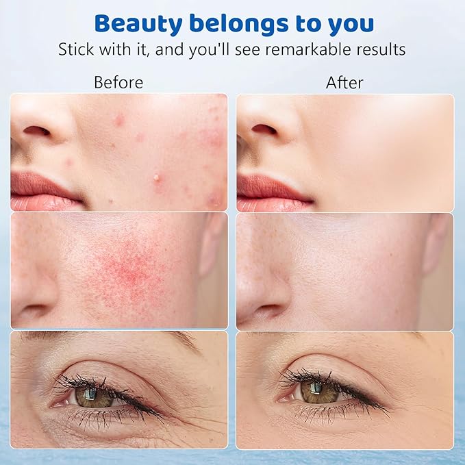 Red & Blue Light Therapy Lamp with 180 LEDs, 3-in-1 Chip, 415nm, 660nm, 850nm for Face & Body