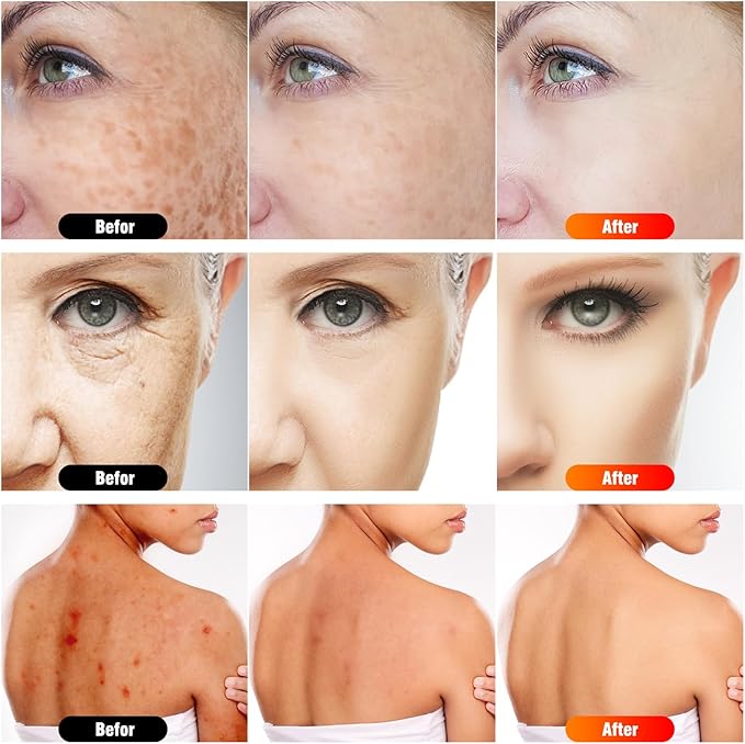 7 in 1 Portable Light Therapy for Face for Body Lamp with Stand, 920nm Red Infrared Light Therapy Device, LED Face Skin Body Skin Care at Home