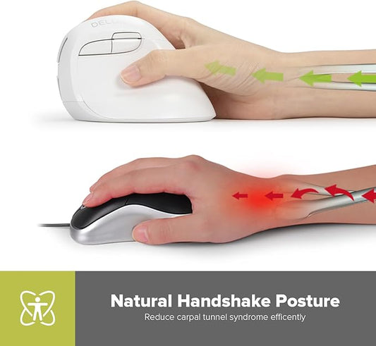 DeLUX Wireless Small Ergonomic Mouse, Silent BT Vertical Mouse, 6 Buttons and 4000 DPI, Reduce Wrist Pain and Hand Pressure, for PC Computer Laptop (M618Mini DB-White)