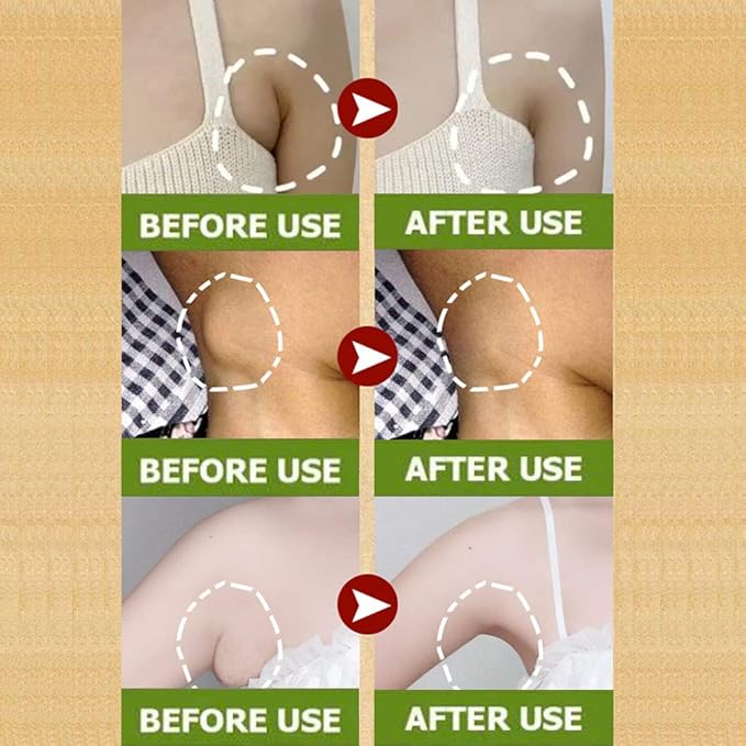 LAVELA 20 pcs Lymphatic Drainage Patch Herbal Lymph Care Patch Neck Lymph Node Patch Anti-Swelling Ginger Oil Lymphatic Drainage Massage